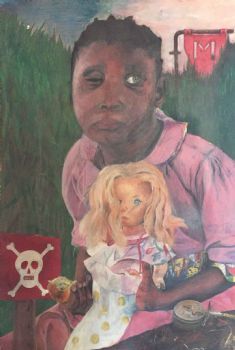 "Landmine Victim"