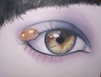 "The Eye"