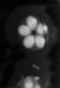 "Thanatology I"