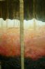 "Copper Diptych"