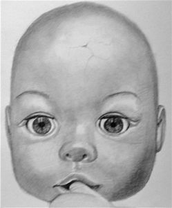 "Broken Child"